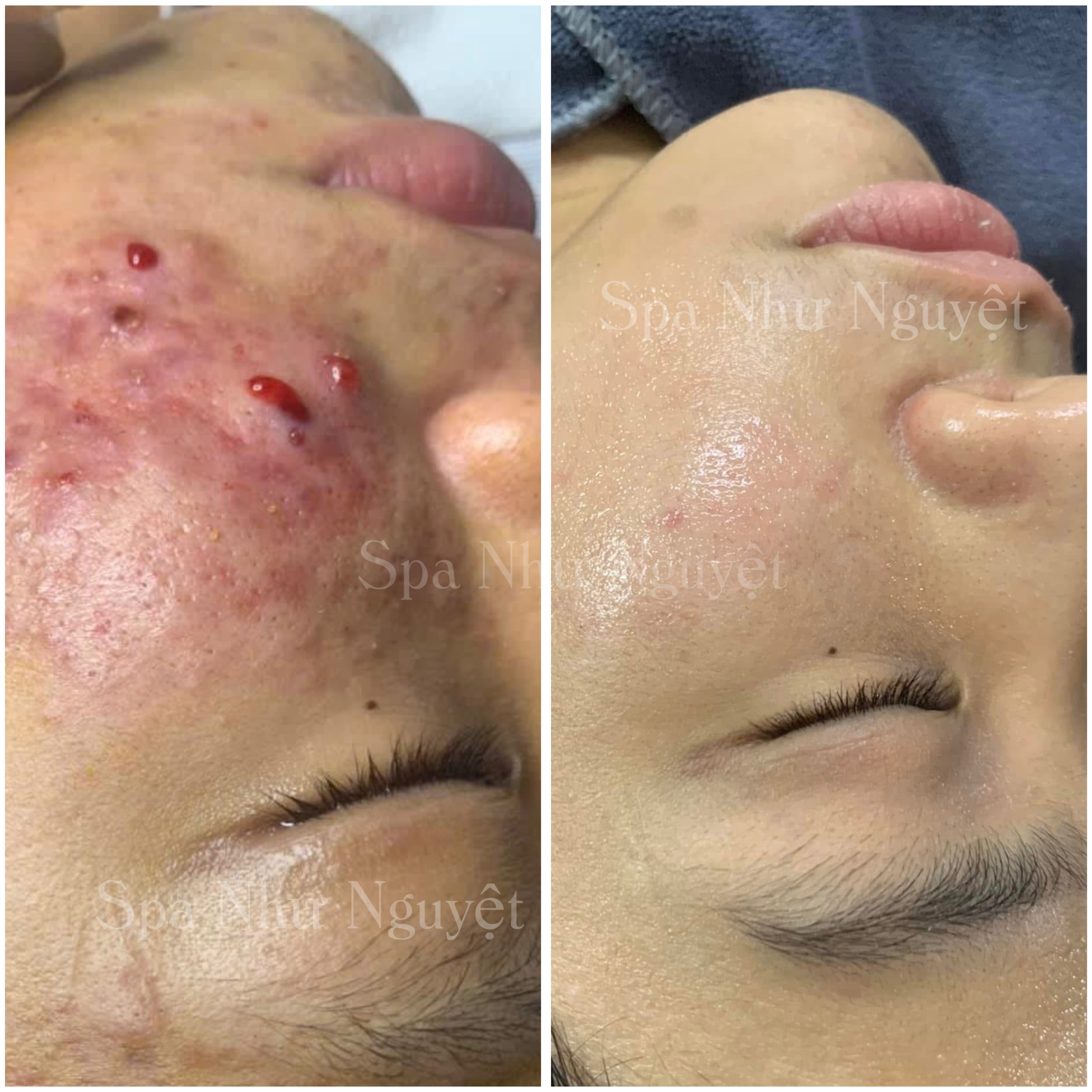 Gội dưỡng sinh