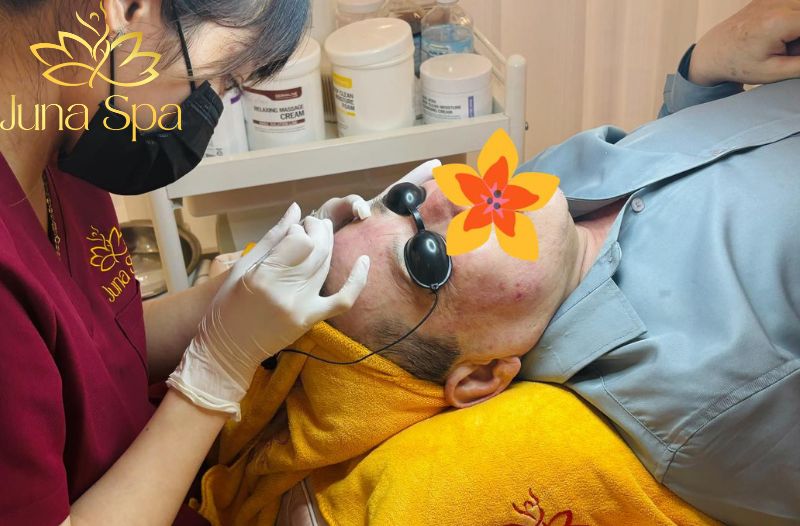 Lấy nhân mụn cơ bản